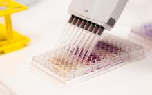 Multichannel pipette dispensing liquid samples into a microplate in a laboratory.
